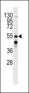 ADRB2 Antibody - Western blot of anti-BAR2 Antibody (S261) in mouse kidney lysates (35 ug/lane). BAR2 (arrow) was detected using the purified antibody.