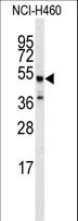 ADRB2 Antibody - Western blot of anti-ADRB2 Antibody (S364) in NCI-H460 cell line lysates (35 ug/lane). ADRB2 (arrow) was detected using the purified antibody.