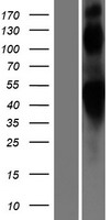 ADRB2 Protein - Western validation with an anti-DDK antibody * L: Control HEK293 lysate R: Over-expression lysate