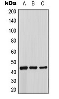 ADRB3 Antibody - Western blot analysis of Beta-3 Adrenergic Receptor expression in MCF7 (A); mouse kidney (B); rat liver (C) whole cell lysates.