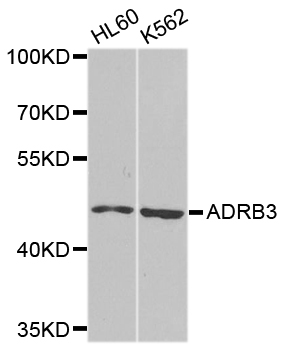 ADRB3 Antibody - Western blot analysis of extracts of various cell lines.