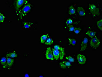 ADRB3 Antibody - Immunofluorescent analysis of MCF-7 cells using ADRB3 Antibody at dilution of 1:100 and Alexa Fluor 488-congugated AffiniPure Goat Anti-Rabbit IgG(H+L)