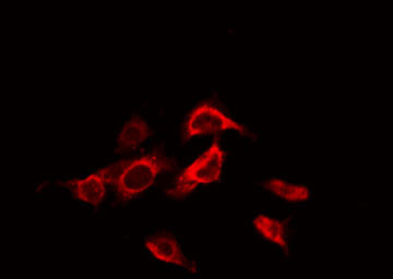 ADRB3 Antibody - Staining K562 cells by IF/ICC. The samples were fixed with PFA and permeabilized in 0.1% Triton X-100, then blocked in 10% serum for 45 min at 25°C. The primary antibody was diluted at 1:200 and incubated with the sample for 1 hour at 37°C. An Alexa Fluor 594 conjugated goat anti-rabbit IgG (H+L) Ab, diluted at 1/600, was used as the secondary antibody.