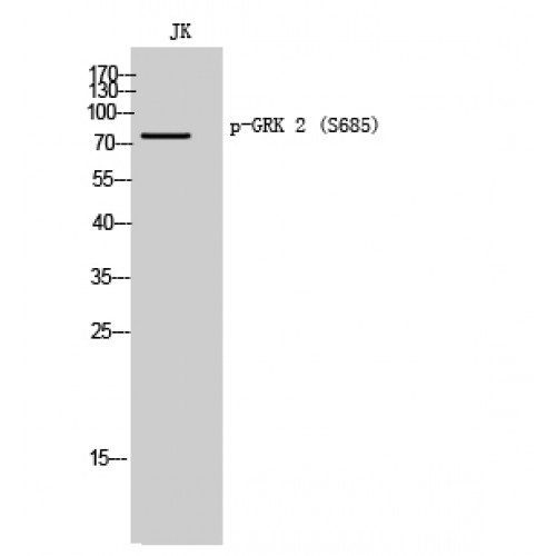 ADRBK1 / GRK2 Antibody - Western blot of Phospho-GRK 2 (S685) antibody