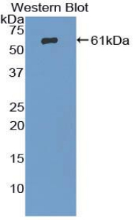 ADRBK1 / GRK2 Antibody - Western blot of recombinant GRK2.