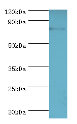 ADRBK1 / GRK2 Antibody - Western blot. All lanes: ADRBK1 antibody at 3 ug/ml+mouse brain tissue. Secondary antibody: Goat polyclonal to rabbit at 1:10000 dilution. Predicted band size: 80 kDa. Observed band size: 80 kDa.