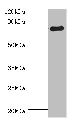 ADRBK1 / GRK2 Antibody - Western blot All lanes: ADRBK1 antibody at 3µg/ml + Mouse brain tissue Secondary Goat polyclonal to rabbit IgG at 1/10000 dilution Predicted band size: 80 kDa Observed band size: 80 kDa