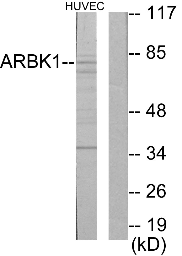 ADRBK1 / GRK2 Antibody - Western blot analysis of lysates from HUVEC cells, using ARBK1 Antibody. The lane on the right is blocked with the synthesized peptide.