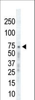 ADRBK1 / GRK2 Antibody - Western blot of anti-GRK2 C-term antibody in Ramos cell lysate. GRK2 (arrow) was detected using purified antibody. Secondary HRP-anti-rabbit was used for signal visualization with chemiluminescence.