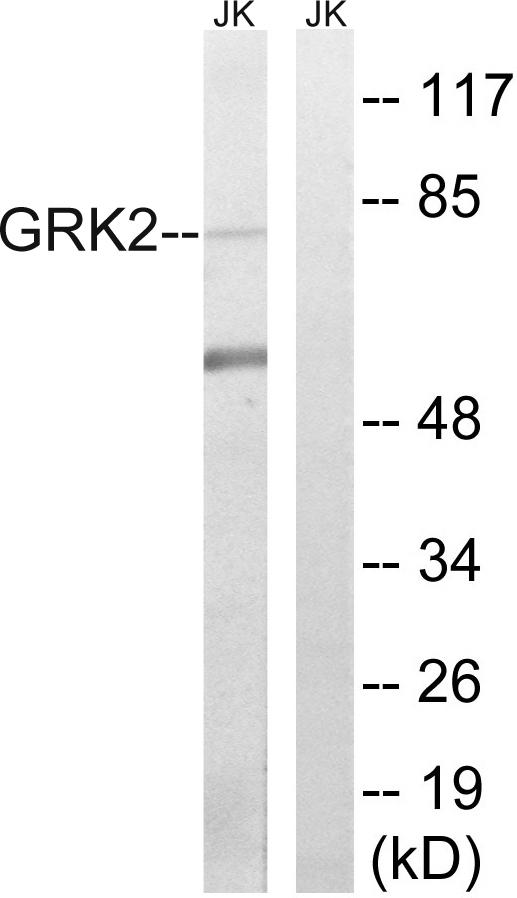 ADRBK1 / GRK2 Antibody - Western blot analysis of extracts from Jurkat cells, using GRK2 (Ab-685) antibody.
