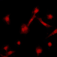 ADRBK1 / GRK2 Antibody - Immunofluorescent analysis of GRK2 staining in HeLa cells. Formalin-fixed cells were permeabilized with 0.1% Triton X-100 in TBS for 5-10 minutes and blocked with 3% BSA-PBS for 30 minutes at room temperature. Cells were probed with the primary antibody in 3% BSA-PBS and incubated overnight at 4 C in a humidified chamber. Cells were washed with PBST and incubated with a DyLight 594-conjugated secondary antibody (red) in PBS at room temperature in the dark. DAPI was used to stain the cell nuclei (blue).