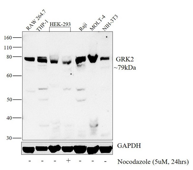 ADRBK1 / GRK2 Antibody - GRK2 Antibody in Western Blot (WB)