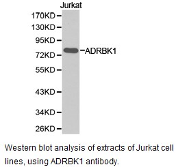 ADRBK1 / GRK2 Antibody - Western blot.