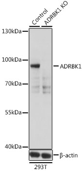 ADRBK1 / GRK2 Antibody - Western blot analysis of extracts from normal (control) and ADRBK1 knockout (KO) 293T cells, using ADRBK1 antibodyat 1:500 dilution. The secondary antibody used was an HRP Goat Anti-Rabbit IgG (H+L) at 1:10000 dilution. Lysates were loaded 25ug per lane and 3% nonfat dry milk in TBST was used for blocking. An ECL Kit was used for detection and the exposure time was 1s.