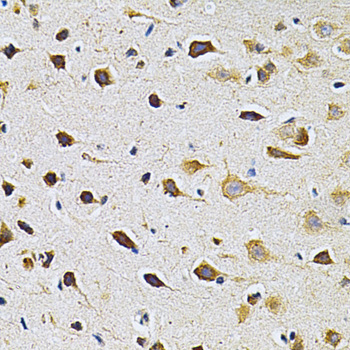 ADRBK1 / GRK2 Antibody - Immunohistochemistry of paraffin-embedded rat brain using ADRBK1 Antibodyat dilution of 1:200 (40x lens).