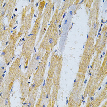 ADRBK1 / GRK2 Antibody - Immunohistochemistry of paraffin-embedded rat heart using ADRBK1 Antibodyat dilution of 1:200 (40x lens).