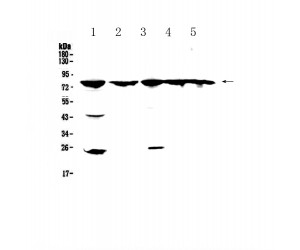 ADRBK1 / GRK2 Antibody - Western blot analysis of GRK2 using anti-GRK2 antibody