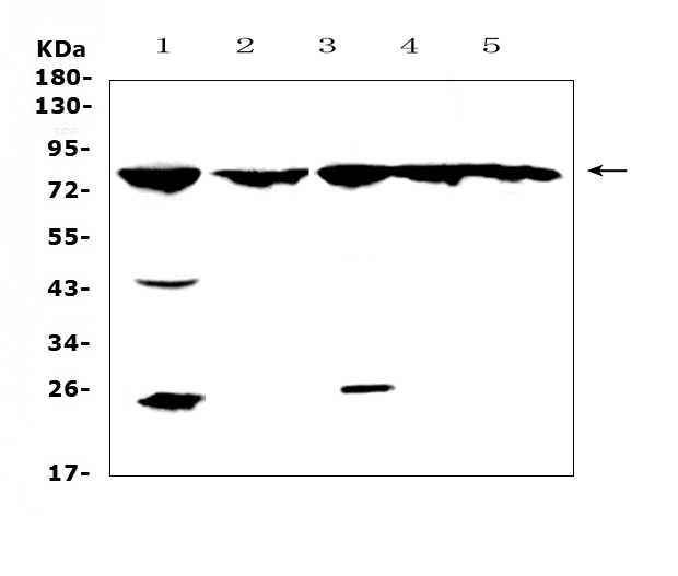 ADRBK1 / GRK2 Antibody - Western blot analysis of GRK2 using anti-GRK2 antibody. Electrophoresis was performed on a 5-20% SDS-PAGE gel at 70V (Stacking gel) / 90V (Resolving gel) for 2-3 hours. The sample well of each lane was loaded with 50ug of sample under reducing conditions. Lane 1: rat spleen tissue lysates,Lane 2: rat stomach tissue lysates,Lane 3: mouse lung tissue lysates,Lane 4: mouse liver tissue lysates,Lane 5: mouse pancreas tissue lysates. After Electrophoresis, proteins were transferred to a Nitrocellulose membrane at 150mA for 50-90 minutes. Blocked the membrane with 5% Non-fat Milk/ TBS for 1.5 hour at RT. The membrane was incubated with rabbit anti-GRK2 antigen affinity purified polyclonal antibody at 0.5 µg/mL overnight at 4°C, then washed with TBS-0.1% Tween 3 times with 5 minutes each and probed with a goat anti-rabbit IgG-HRP secondary antibody at a dilution of 1:10000 for 1.5 hour at RT. The signal is developed using an Enhanced Chemiluminescent detection (ECL) kit with Tanon 5200 system. A specific band was detected for GRK2 at approximately 79KD. The expected band size for GRK2 is at 79KD.