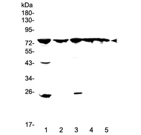 ADRBK1 / GRK2 Antibody - Western blot testing of 1) rat spleen, 2) rat stomach, 3) mouse lung, 4) mouse liver and 5) mouse pancreas lysate wtih GRK2 antibody at 0.5ug/ml. Predicted molecular weight ~79 kDa.