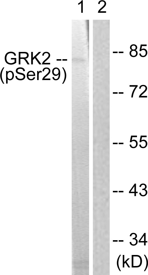 ADRBK1 / GRK2 Antibody - Western blot analysis of lysates from Jurkat cells treated with EGF 200ng/ml 30', using GRK2 (Phospho-Ser29) Antibody. The lane on the right is blocked with the phospho peptide.