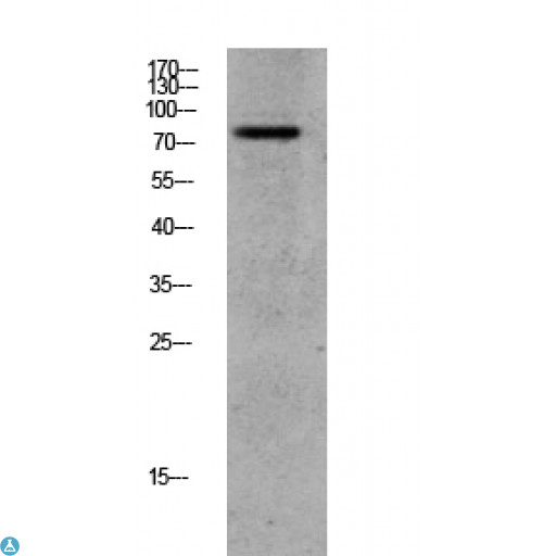 ADRBK1 / GRK2 Antibody - Western blot analysis of CACO2 lysate, antibody was diluted at 1000. Secondary antibody was diluted at 1: 20000.