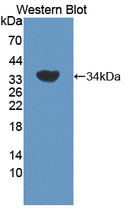 ADRBK2 / GRK3 Antibody - Western blot of ADRBK2 / GRK3 antibody.