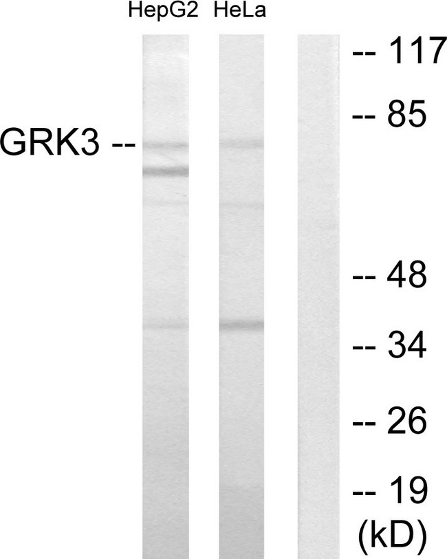 ADRBK2 / GRK3 Antibody - Western blot analysis of lysates from HepG2 and HeLa cells, using GRK3 Antibody. The lane on the right is blocked with the synthesized peptide.