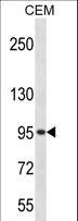 ADRBK2 / GRK3 Antibody - Mouse Adrbk2 Antibody western blot of CEM cell line lysates (35 ug/lane). The Adrbk2 antibody detected the Adrbk2 protein (arrow).