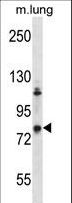 ADRBK2 / GRK3 Antibody - Mouse Adrbk2 Antibody western blot of mouse lung tissue lysates (35 ug/lane). The Adrbk2 antibody detected the Adrbk2 protein (arrow).