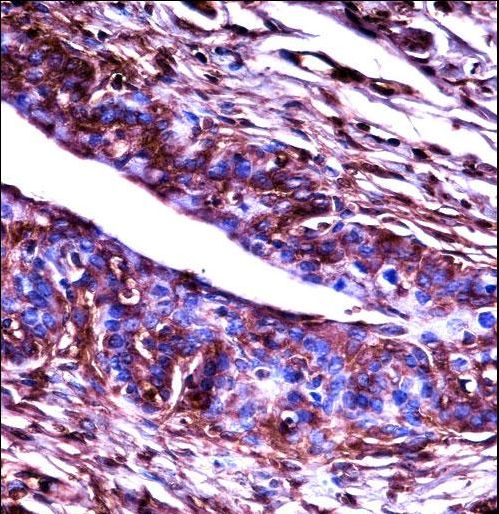 ADRBK2 / GRK3 Antibody - Mouse Adrbk2 Antibody immunohistochemistry of formalin-fixed and paraffin-embedded mouse cervix tissue followed by peroxidase-conjugated secondary antibody and DAB staining.