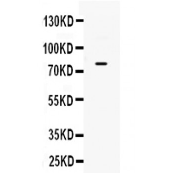 ADRBK2 / GRK3 Antibody - GRK antibody Western blot. All lanes: Anti GRK3 at 0.5 ug/ml. WB: JURKAT Whole Cell Lysate at 40 ug. Predicted band size: 80 kD. Observed band size: 80 kD.