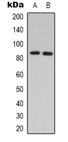 ADRBK2 / GRK3 Antibody - Western blot analysis of GRK3 expression in HeLa (A); HL60 (B) whole cell lysates.