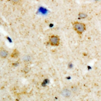 ADRBK2 / GRK3 Antibody - Immunohistochemical analysis of GRK3 staining in human brain formalin fixed paraffin embedded tissue section. The section was pre-treated using heat mediated antigen retrieval with sodium citrate buffer (pH 6.0). The section was then incubated with the antibody at room temperature and detected using an HRP polymer system. DAB was used as the chromogen. The section was then counterstained with hematoxylin and mounted with DPX.