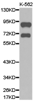 ADRBK2 / GRK3 Antibody - Western blot of extracts of K-562 cell lines, using ADRBK2 antibody.