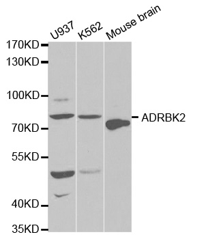 ADRBK2 / GRK3 Antibody - Western blot analysis of extracts of various cell lines.