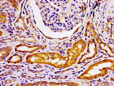 ADRBK2 / GRK3 Antibody - Immunohistochemistry image of paraffin-embedded human kidney tissue at a dilution of 1:100