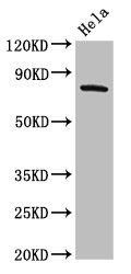 ADRBK2 / GRK3 Antibody - Positive Western Blot detected in Hela whole cell lysate. All lanes: GRK3 antibody at 2 µg/ml Secondary Goat polyclonal to rabbit IgG at 1/50000 dilution. Predicted band size: 80 KDa. Observed band size: 80 KDa