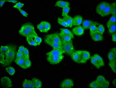 ADRBK2 / GRK3 Antibody - Immunofluorescence staining of HepG2 cells with GRK3 Antibody at 1:66, counter-stained with DAPI. The cells were fixed in 4% formaldehyde, permeabilized using 0.2% Triton X-100 and blocked in 10% normal Goat Serum. The cells were then incubated with the antibody overnight at 4°C. The secondary antibody was Alexa Fluor 488-congugated AffiniPure Goat Anti-Rabbit IgG(H+L).