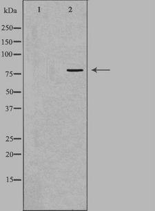 ADRBK2 / GRK3 Antibody - Western blot analysis of extracts of HepG2 cells using GRK3 antibody. The lane on the left is treated with the antigen-specific peptide.