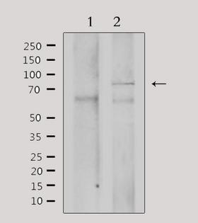 ADRBK2 / GRK3 Antibody - Western blot analysis of extracts of mouse brain tissue using GRK3 antibody. Lane 1 was treated with the antigen-specific peptide.