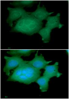 ADRM1 Antibody - ICC/IF analysis of ADRM1 in MCF7 cells line, stained with DAPI (Blue) for nucleus staining and monoclonal anti-human ADRM1 antibody (1:100) with goat anti-mouse IgG-Alexa fluor 488 conjugate (Green).