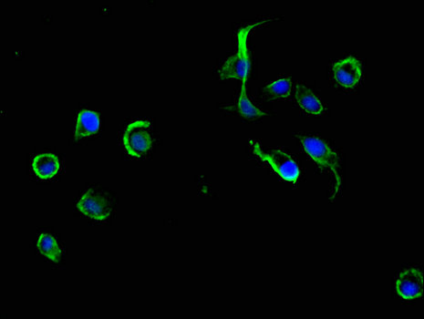 ADRM1 Antibody - Immunofluorescent analysis of MCF-7 cells using ADRM1 Antibody at a dilution of 1:100 and Alexa Fluor 488-congugated AffiniPure Goat Anti-Rabbit IgG(H+L)