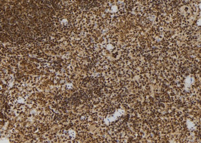 ADRM1 Antibody - 1:100 staining mouse spleen tissue by IHC-P. The sample was formaldehyde fixed and a heat mediated antigen retrieval step in citrate buffer was performed. The sample was then blocked and incubated with the antibody for 1.5 hours at 22°C. An HRP conjugated goat anti-rabbit antibody was used as the secondary.