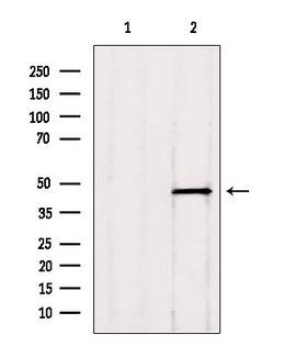 ADRM1 Antibody - Western blot analysis of extracts of HepG2 cells using ADRM1 antibody. Lane 1 was treated with the blocking peptide.