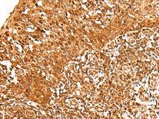 ADRM1 Antibody - Immunohistochemistry of paraffin-embedded Human tonsil tissue  using ADRM1 Polyclonal Antibody at dilution of 1:30(×200)