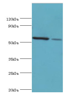 ADSL / Adenylosuccinate Lyase Antibody - Western blot. All lanes: Adenylosuccinate lyase antibody at 2 ug/ml. Lane 1: HeLa whole cell lysate. Lane 2: mouse heart tissue. Secondary antibody: Goat polyclonal to rabbit at 1:10000 dilution. Predicted band size: 55 kDa. Observed band size: 55 kDa.