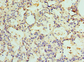ADSL / Adenylosuccinate Lyase Antibody - Immunohistochemistry of paraffin-embedded human lung using antibody at 1:100 dilution.