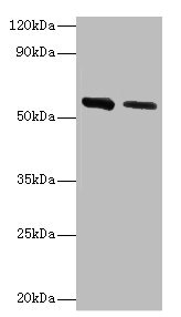 ADSL / Adenylosuccinate Lyase Antibody - Western blot All lanes: ADSL antibody at 2µg/ml Lane 1: Hela whole cell lysate Lane 2: Mouse heart tissue Secondary Goat polyclonal to rabbit IgG at 1/10000 dilution Predicted band size: 55, 49 kDa Observed band size: 55 kDa