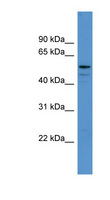 ADSL / Adenylosuccinate Lyase Antibody - ADSL antibody Western blot of Fetal Muscle lysate.  This image was taken for the unconjugated form of this product. Other forms have not been tested.