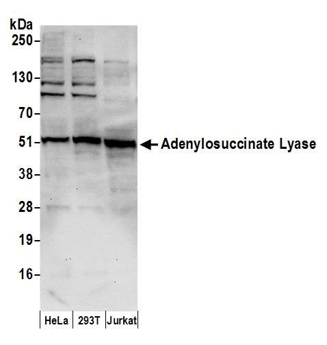 ADSL / Adenylosuccinate Lyase Antibody - Detection of human Adenylosuccinate Lyase/ADSL by western blot. Samples: Whole cell lysate (50 µg) from HeLa, HEK293T, and Jurkat cells prepared using NETN lysis buffer. Antibody: Affinity purified rabbit anti-Adenylosuccinate Lyase/ADSL antibody used for WB at 0.1 µg/ml. Detection: Chemiluminescence with an exposure time of 30 seconds.